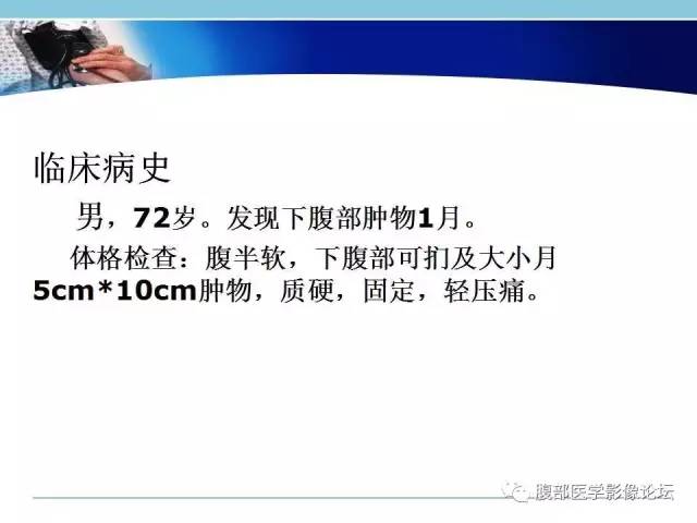 【病例】小肠系膜脂肪肉瘤1例CT影像表现