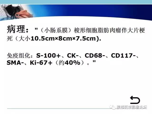 【病例】小肠系膜脂肪肉瘤1例CT影像表现 【病例】小肠系膜脂肪肉瘤1例CT影像表现