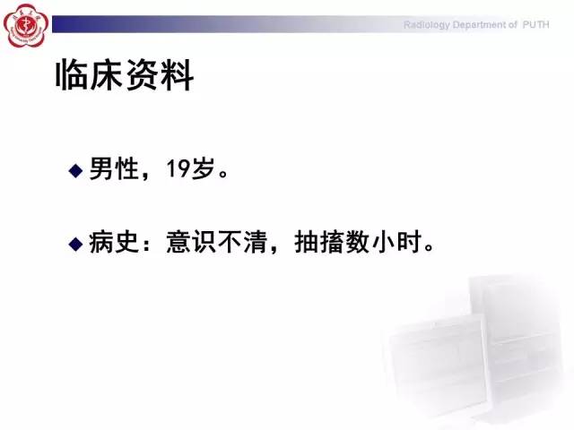 【病例】胚胎发育不良性神经上皮瘤1例CT及MR影像诊断与鉴别