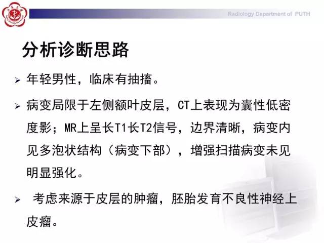 【病例】胚胎发育不良性神经上皮瘤1例CT及MR影像诊断与鉴别