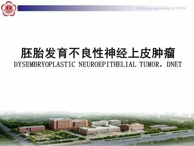 【病例】胚胎发育不良性神经上皮瘤1例CT及MR影像诊断与鉴别