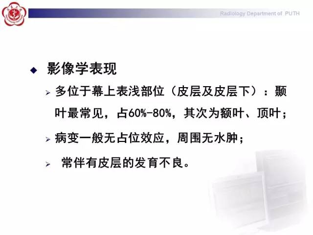 【病例】胚胎发育不良性神经上皮瘤1例CT及MR影像诊断与鉴别