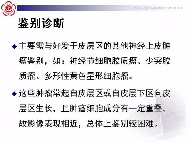 【病例】胚胎发育不良性神经上皮瘤1例CT及MR影像诊断与鉴别