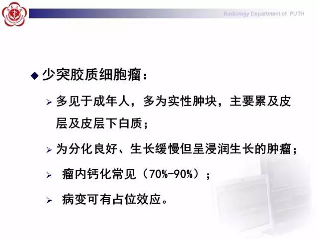 【病例】胚胎发育不良性神经上皮瘤1例CT及MR影像诊断与鉴别