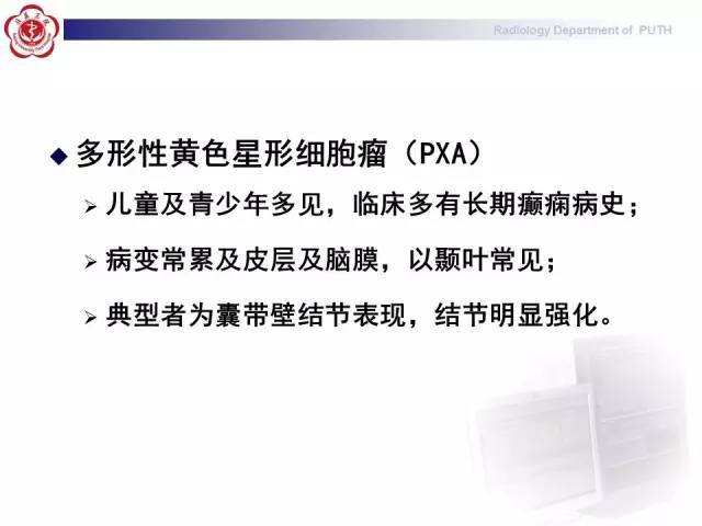 【病例】胚胎发育不良性神经上皮瘤1例CT及MR影像诊断与鉴别