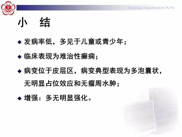【病例】胚胎发育不良性神经上皮瘤1例CT及MR影像诊断与鉴别