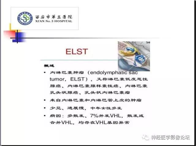 【病例】右侧内淋巴囊瘤1例CT及MR