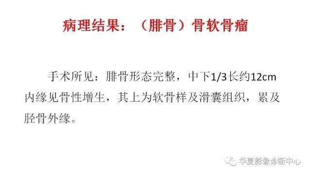 【病例】腓骨骨软骨瘤1例X线CT及MR