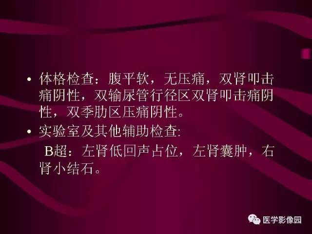 【病例】肾脏恶性纤维组织细胞瘤1例CT影像表现 【病例】肾脏恶性纤维组织细胞瘤1例CT影像表现