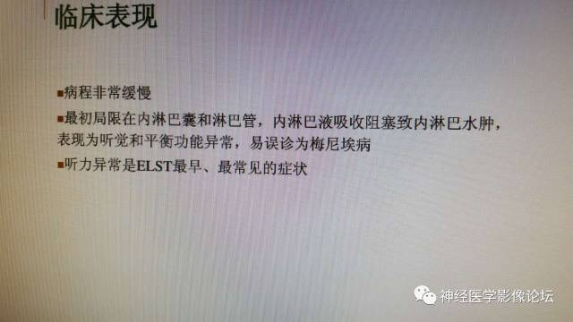 【病例】内淋巴囊瘤1例CT及MR影像表现