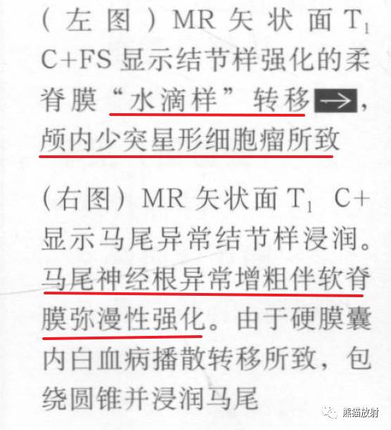 【书摘】“实性强化的硬膜内髓外病变”的鉴别诊断 【书摘】“实性强化的硬膜内髓外病变”的鉴别诊断