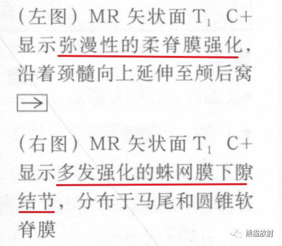 【书摘】“实性强化的硬膜内髓外病变”的鉴别诊断 【书摘】“实性强化的硬膜内髓外病变”的鉴别诊断