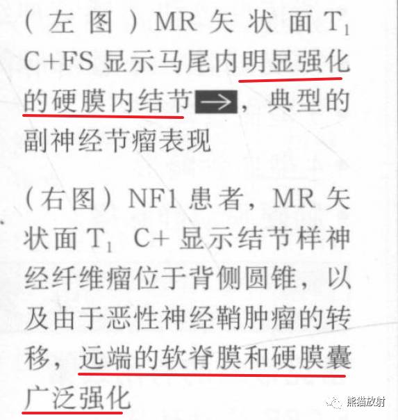【书摘】“实性强化的硬膜内髓外病变”的鉴别诊断 【书摘】“实性强化的硬膜内髓外病变”的鉴别诊断
