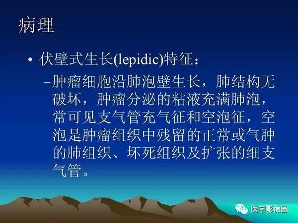 【PPT】细支气管肺泡癌的影像诊断