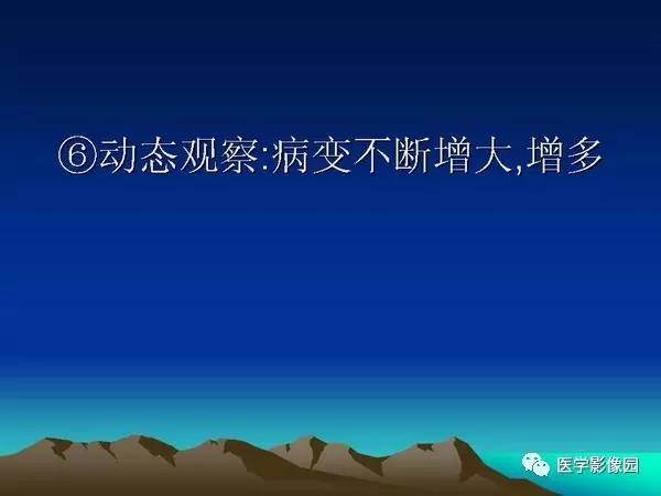 【PPT】细支气管肺泡癌的影像诊断