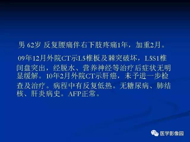 【病例】肝脏结核1例CT影像表现