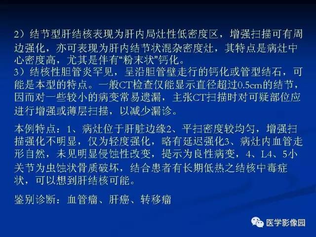 【病例】肝脏结核1例CT影像表现