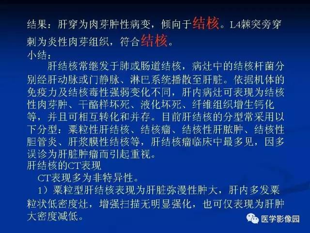 【病例】肝脏结核1例CT影像表现