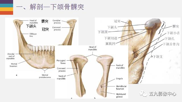 【PPT】颞颌关节病变的MR诊断
