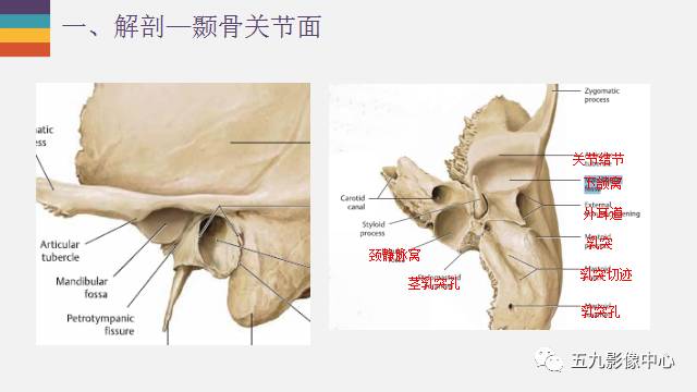 【PPT】颞颌关节病变的MR诊断