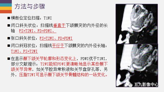 【PPT】颞颌关节病变的MR诊断
