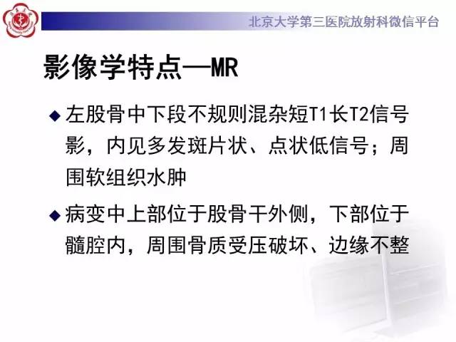 【病例】血友病性假肿瘤1例X线CT影像诊断与鉴别