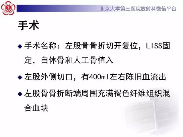 【病例】血友病性假肿瘤1例X线CT影像诊断与鉴别
