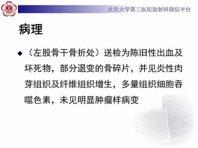 【病例】血友病性假肿瘤1例X线CT影像诊断与鉴别