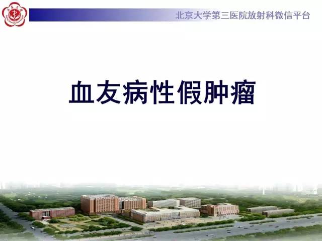 【病例】血友病性假肿瘤1例X线CT影像诊断与鉴别