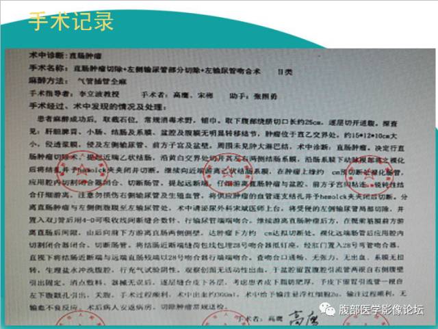 【病例】直肠副神经节细胞瘤1例CT及MR 【病例】直肠副神经节细胞瘤1例CT及MR