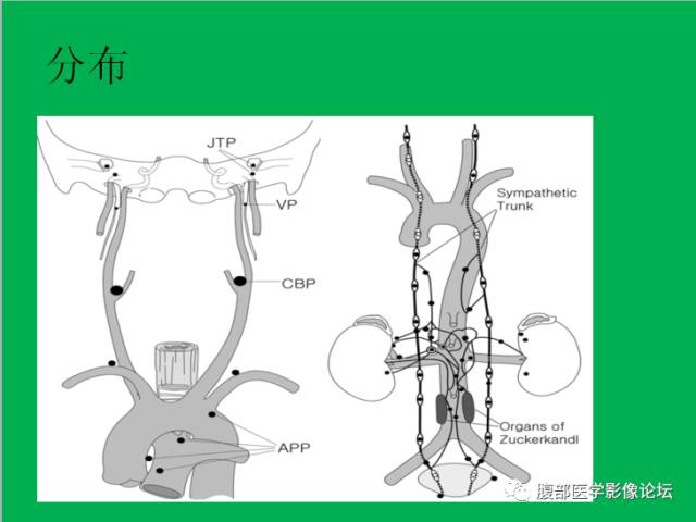 【病例】直肠副神经节细胞瘤1例CT及MR 【病例】直肠副神经节细胞瘤1例CT及MR