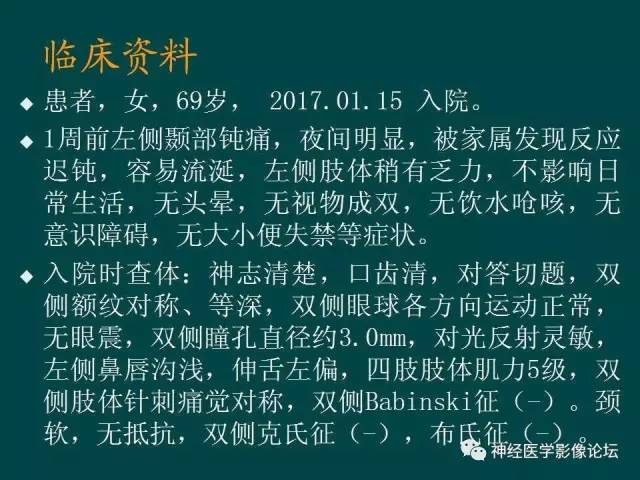 【病例】右额叶出血性脑梗死1例CT及MR影像表现