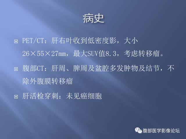 【病例】肝周恶性间皮瘤1例CT及MR影像表现 【病例】肝周恶性间皮瘤1例CT及MR影像表现