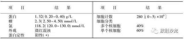 【病例】一侧静脉窦血栓1例CT及MR 【病例】一侧静脉窦血栓1例CT及MR