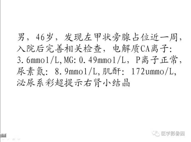 【病例】左甲状旁腺腺瘤1例CT影像表现