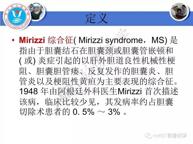 【PPT】Mirizzi 综合征