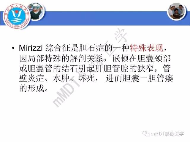 【PPT】Mirizzi 综合征