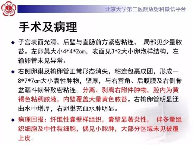 【病例】卵巢巧克力囊肿继发感染1例MR影像表现