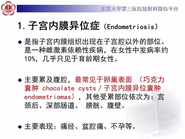 【病例】卵巢巧克力囊肿继发感染1例MR影像表现