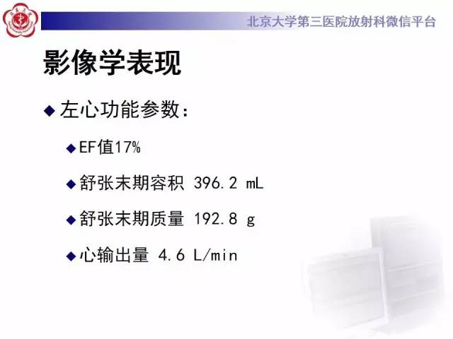 【病例】冠心病心肌梗死伴心尖部室壁瘤形成1例MR