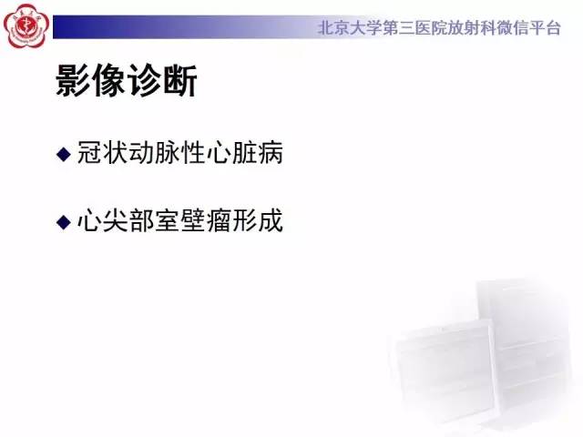 【病例】冠心病心肌梗死伴心尖部室壁瘤形成1例MR