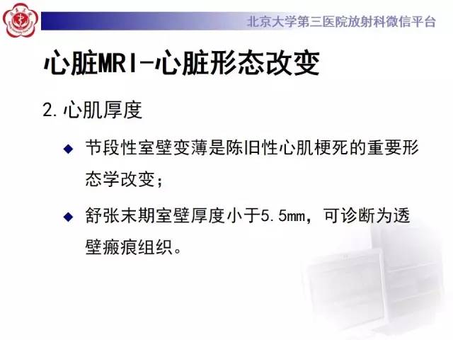 【病例】冠心病心肌梗死伴心尖部室壁瘤形成1例MR