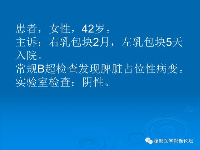 【病例】脾脏淋巴管瘤1例CT影像表现 【病例】脾脏淋巴管瘤1例CT影像表现