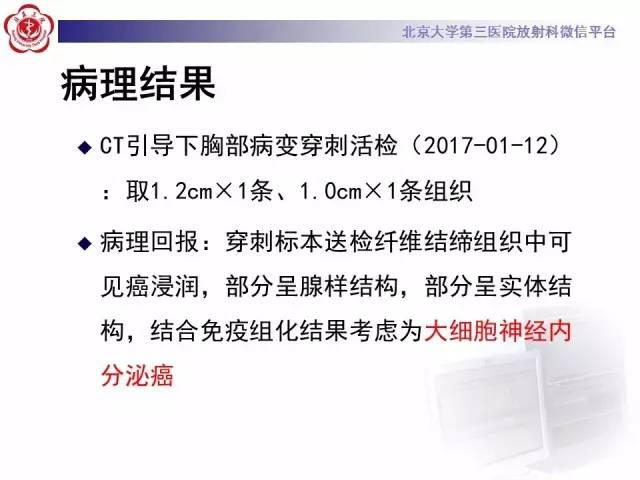 【病例】左肺尖神经内分泌癌1例CT影像表现