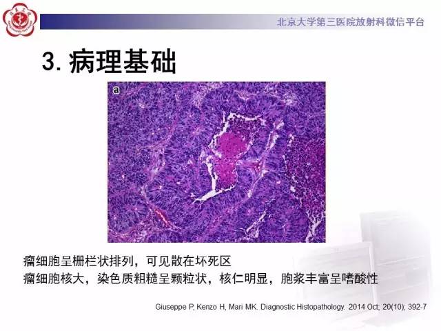 【病例】左肺尖神经内分泌癌1例CT影像表现