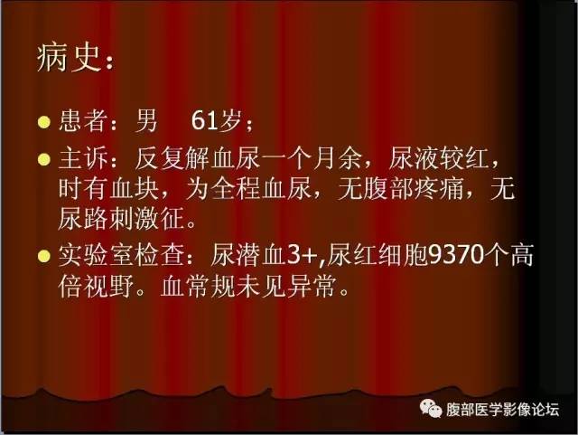 【病例】左肾乳头状细胞癌1例CT影像表现