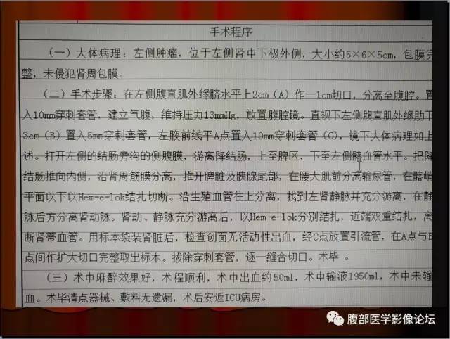 【病例】左肾乳头状细胞癌1例CT影像表现