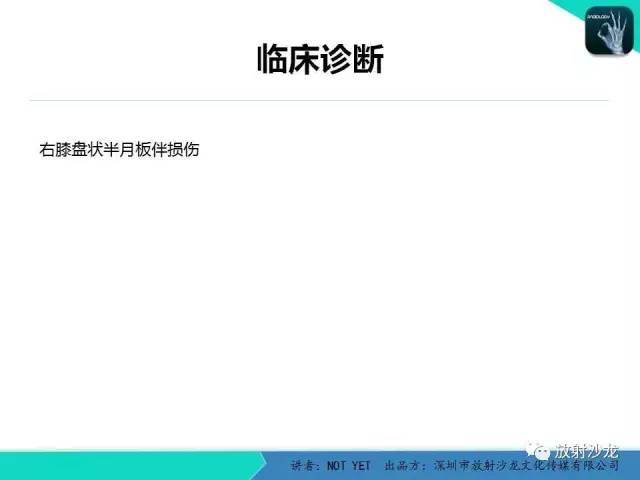 【病例】右膝盘状半月板伴损伤1例MR