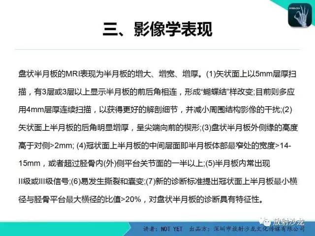 【病例】右膝盘状半月板伴损伤1例MR