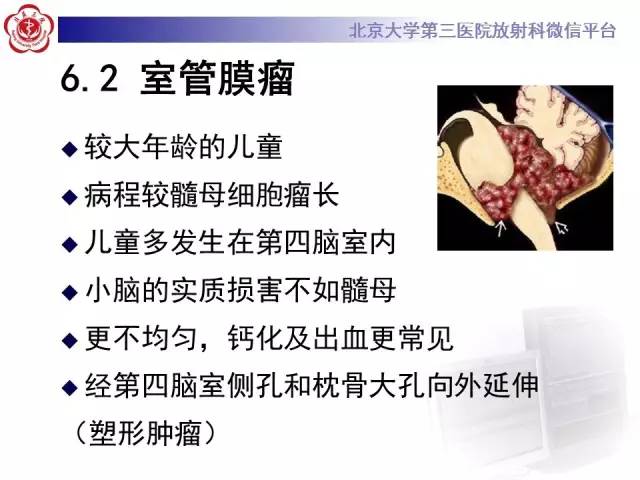 【病例】髓母细胞瘤1例MR影像诊断与鉴别